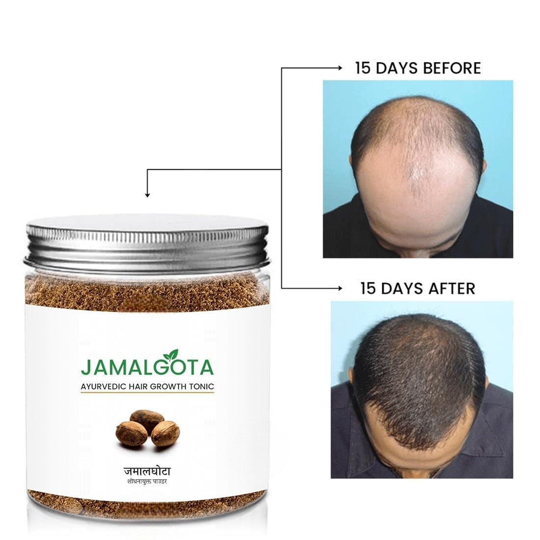 Jamalgota Oil and powder for Hair Growth (Combo) | For Men and Women