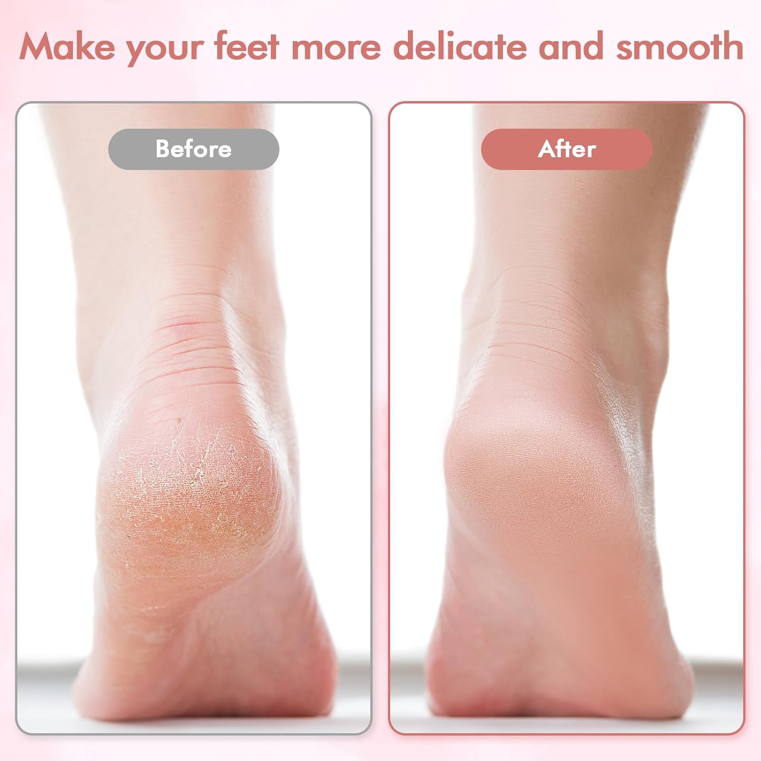 Pink Pedi Electronic Pedicure Tool
